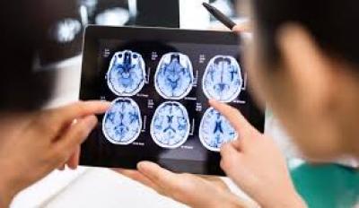 - تقنيات طبية قد تغير وجه العالم..منها زرع الرؤوس ونقل الأدمغة..