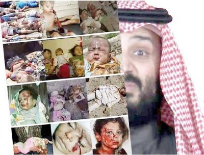- الطفولة في اليمن.. معاناة تتفاقم منذ خمس سنوات..